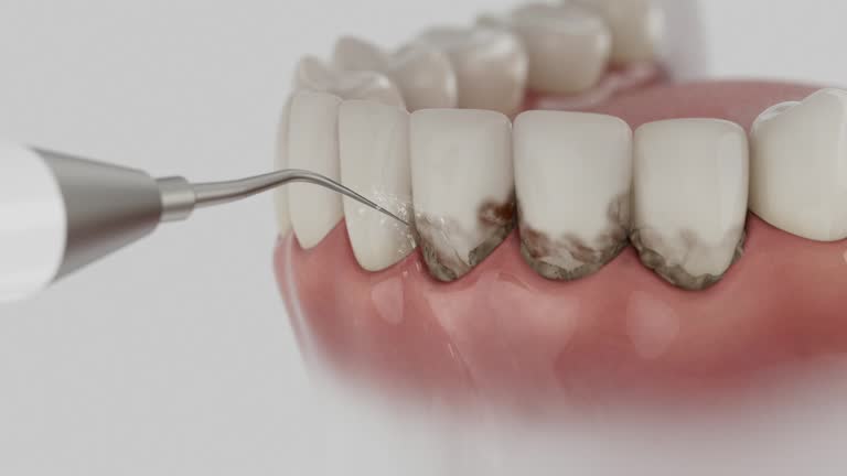 Reliable Tooth Extraction contractor in Boundary County County, ID by Dentist Open Now